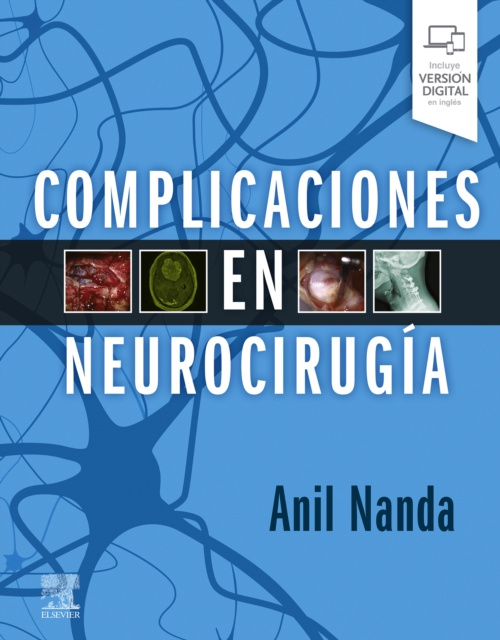 E-kniha Complicaciones en neurocirugia Anil Nanda