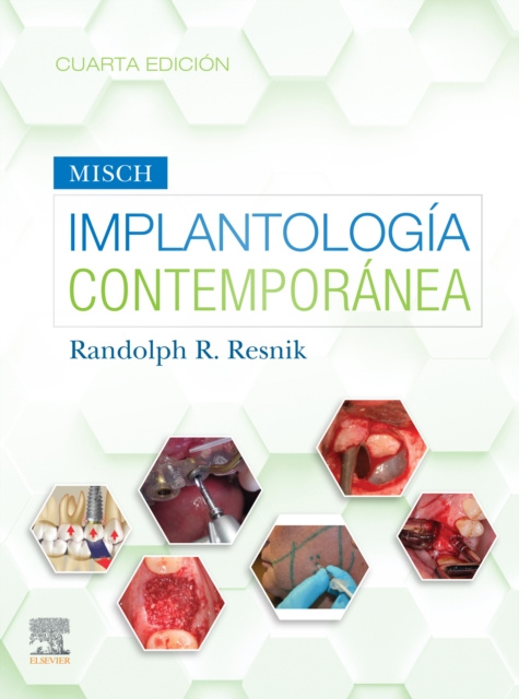 E-kniha Misch. Implantologia contemporanea Randolph Resnik