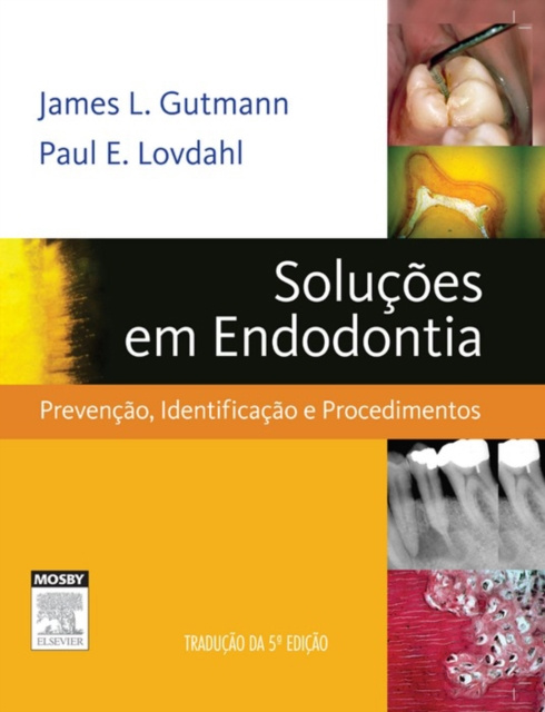 E-kniha Solucoes em Endodontia James L. Gutmann