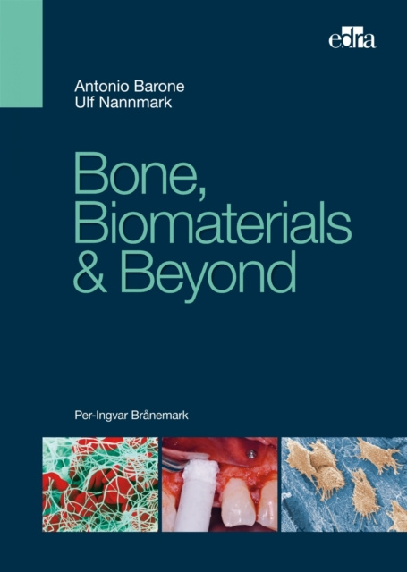 E-kniha Bone, Biomaterials & Beyond Antonio Barone