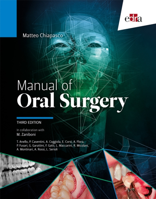 E-kniha Manual of Oral Surgery Matteo Chiapasco