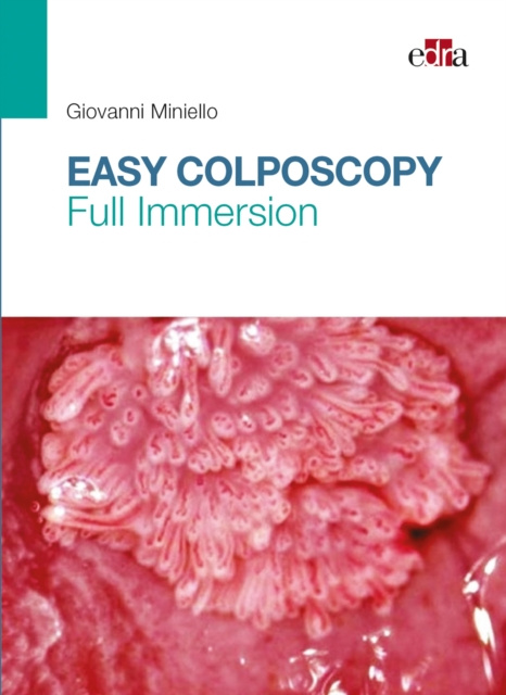 E-book Easy Colposcopy Giovanni Miniello