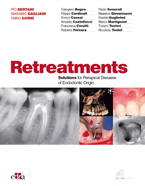 E-book Retreatments Massimo Gagliani