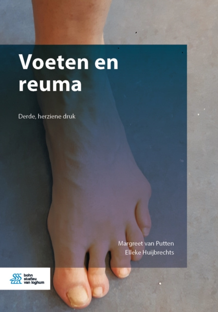 E-kniha Voeten en reuma Margreet van Putten