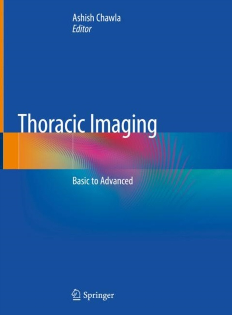 E-book Thoracic Imaging Ashish Chawla