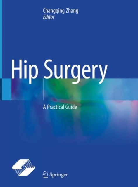 E-knjiga Hip Surgery Changqing Zhang