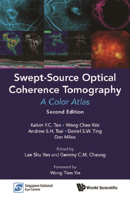 E-book Swept-source Optical Coherence Tomography: A Color Atlas (Second Edition) Teo Kelvin Yi Chong Teo