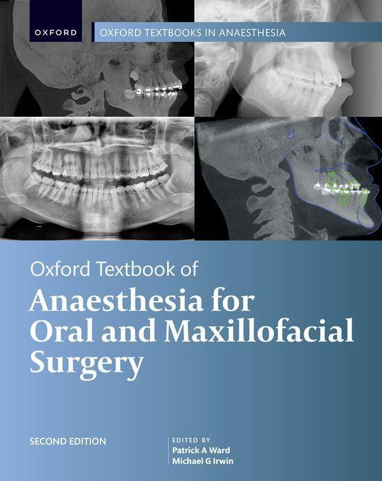 Kniha Oxford Textbook of Anaesthesia for Oral and Maxillofacial Surgery, Second Edition 