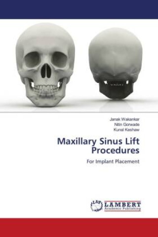 Knjiga Maxillary Sinus Lift Procedures Nitin Gorwade