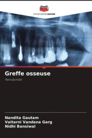 Buch Greffe osseuse Vaitarni Vandana Garg