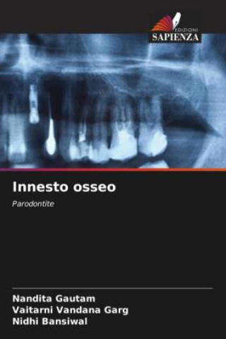 Buch Innesto osseo Vaitarni Vandana Garg