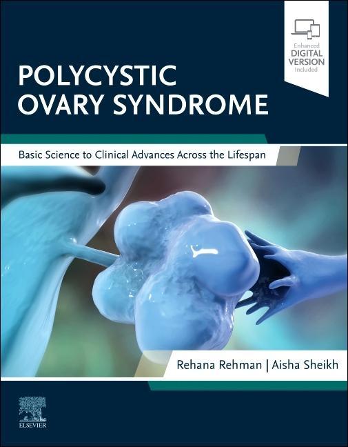 Carte Polycystic Ovary Syndrome Rehana Rehman