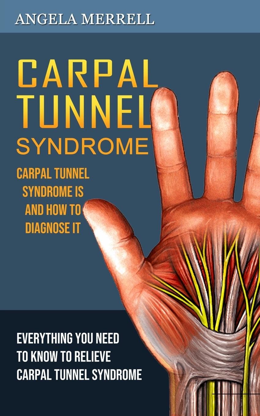 Carte Carpal Tunnel Syndrome 