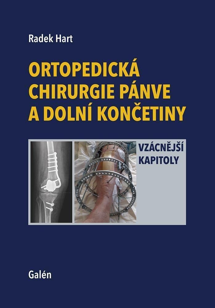 Книга Ortopedická chirurgie pánve a dolní končetiny Radek Hart