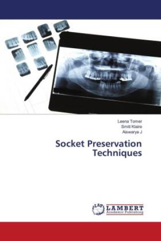 Kniha Socket Preservation Techniques Smiti Klaire