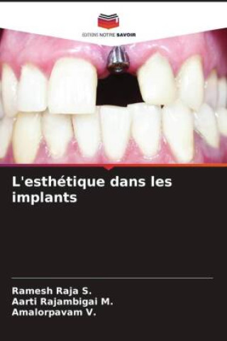 Knjiga L'esthétique dans les implants Aarti Rajambigai M.