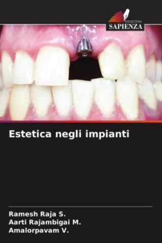 Book Estetica negli impianti Aarti Rajambigai M.