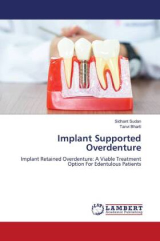 Knjiga Implant Supported Overdenture Tanvi Bharti
