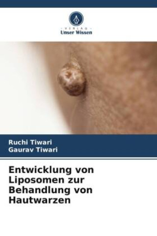 Książka Entwicklung von Liposomen zur Behandlung von Hautwarzen Gaurav Tiwari