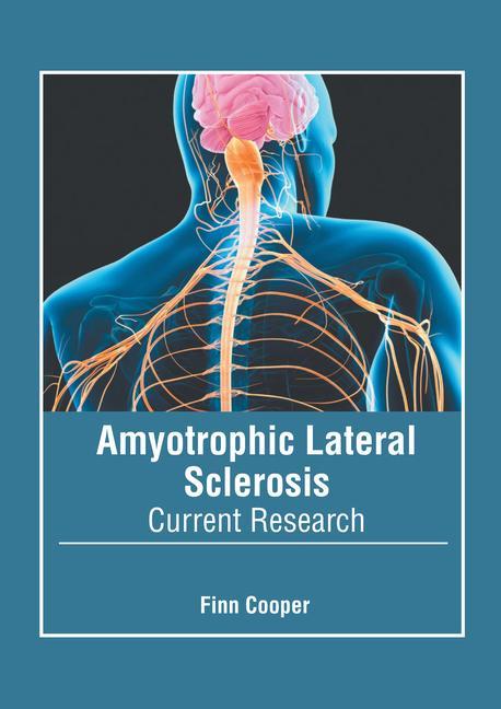 Kniha Amyotrophic Lateral Sclerosis: Current Research 