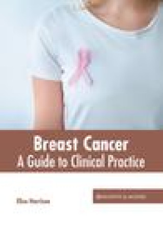 Knjiga Breast Cancer: A Guide to Clinical Practice Eliza Harrison