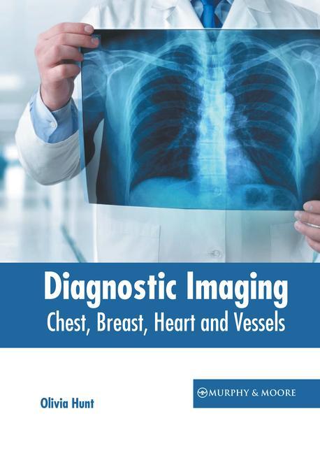 Knjiga Diagnostic Imaging: Chest, Breast, Heart and Vessels Olivia Hunt