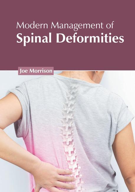 Carte Modern Management of Spinal Deformities 