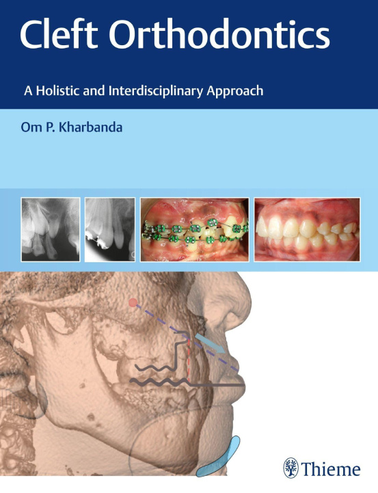 Knjiga Cleft Orthodontics 