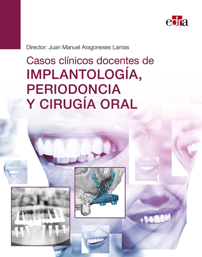 Könyv Casos clínicos docentes de implantología, periodoncia y cirugía oral 