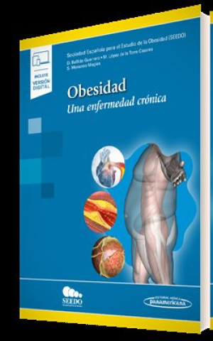 Kniha Obesidad (+ e-book): Una enfermedad crónica 