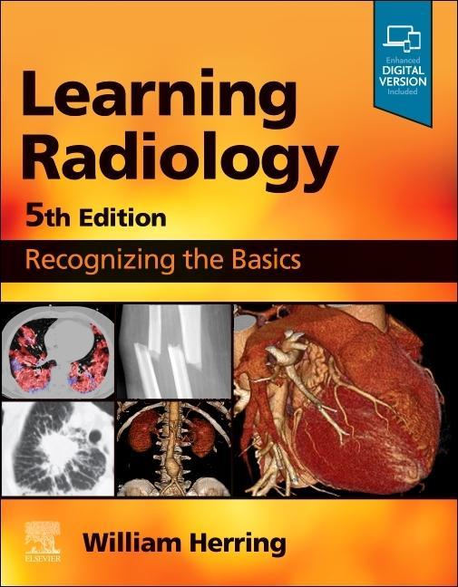 Kniha Learning Radiology William Herring
