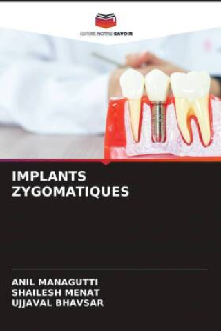 Kniha IMPLANTS ZYGOMATIQUES Anil Managutti