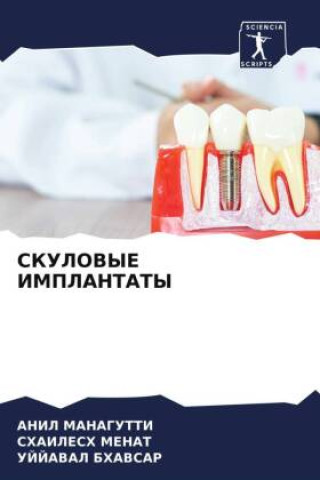 Libro SKULOVYE IMPLANTATY Anil Managutti