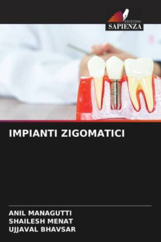 Book IMPIANTI ZIGOMATICI Anil Managutti