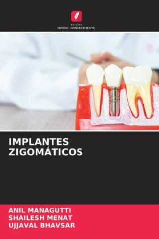 Book IMPLANTES ZIGOMÁTICOS Anil Managutti