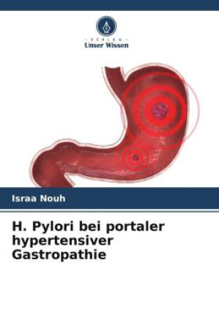 Knjiga H. Pylori bei portaler hypertensiver Gastropathie Israa Nouh