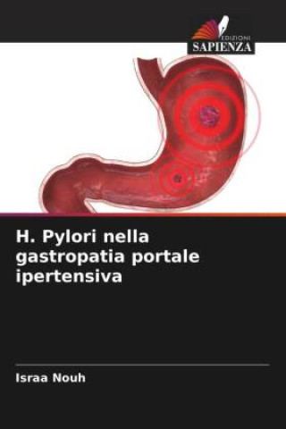 Carte H. Pylori nella gastropatia portale ipertensiva Israa Nouh