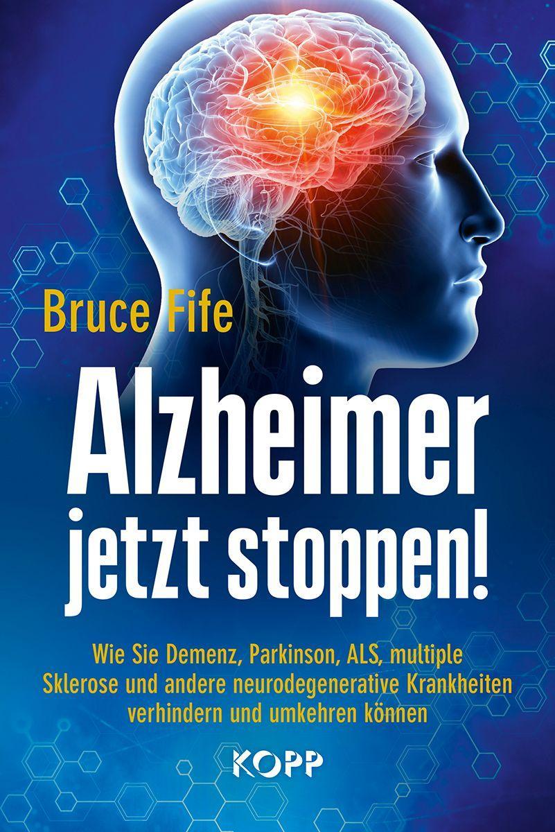 Kniha Alzheimer jetzt stoppen! 