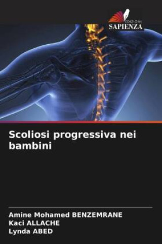 Knjiga Scoliosi progressiva nei bambini Kaci Allache