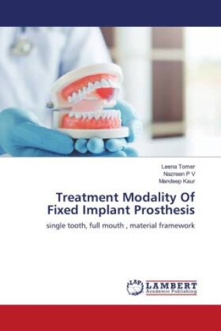 Könyv Treatment Modality Of Fixed Implant Prosthesis Nazreen P V