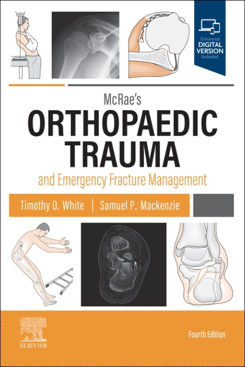 Könyv McRae's Orthopaedic Trauma and Emergency Fracture Management Timothy O White