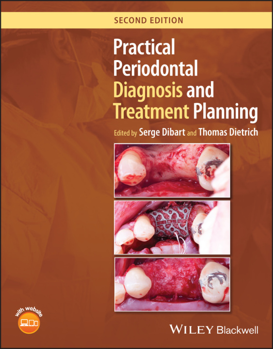 Carte Practical Periodontal Diagnosis and Treatment Planning 
