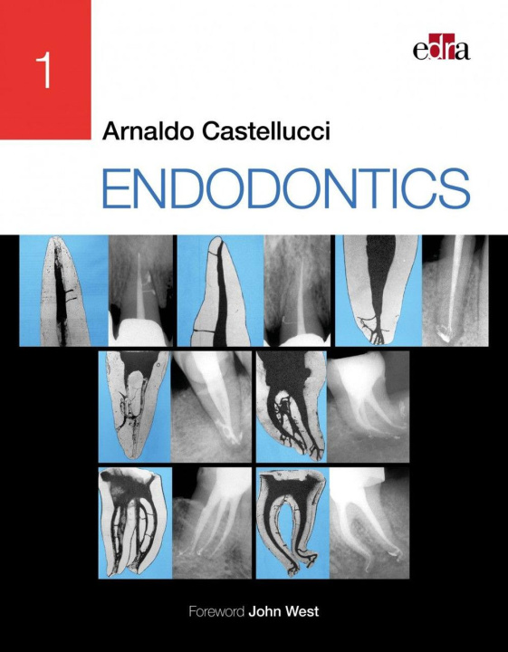 Könyv ENDODONTICS - 2 Volume Set Arnaldo Castellucci