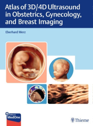 Könyv Atlas of 3D/4D Ultrasound in Obstetrics, Gynecology, and Breast Imaging 