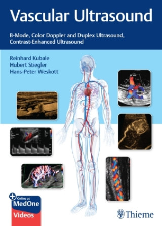 Kniha Vascular Ultrasound Hubert Stiegler