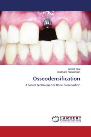 Knjiga Osseodensification Shashank Narasimhan