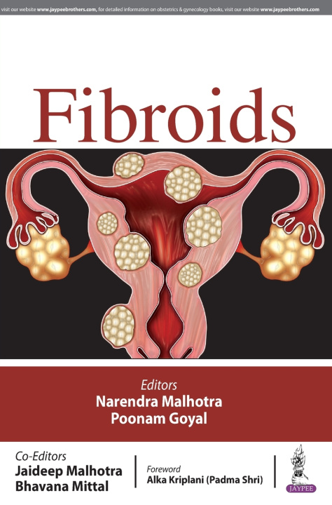 Knjiga FIBROIDS Narendra Malhotra