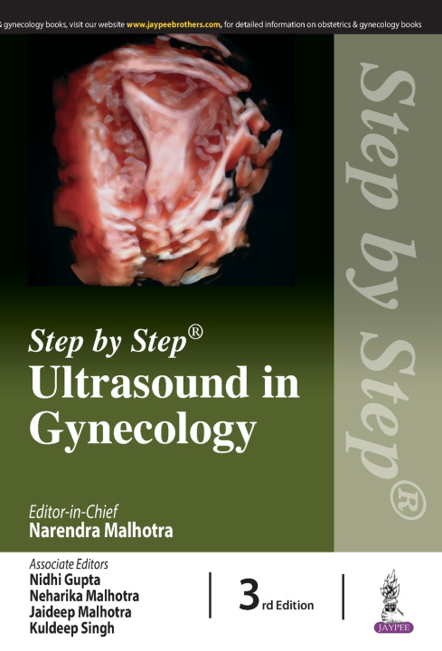 Knjiga Step by Step Ultrasound in Gynecology Narendra Malhotra