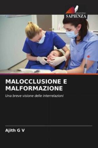 Knjiga MALOCCLUSIONE E MALFORMAZIONE Ajith G V