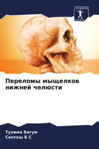 Knjiga Perelomy myschelkow nizhnej chelüsti Santosh B S